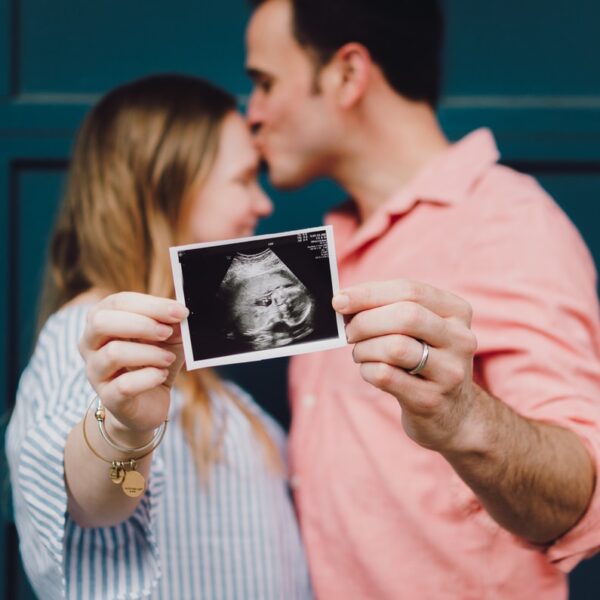 man kissing woman's forehead white holding ultrasound photo