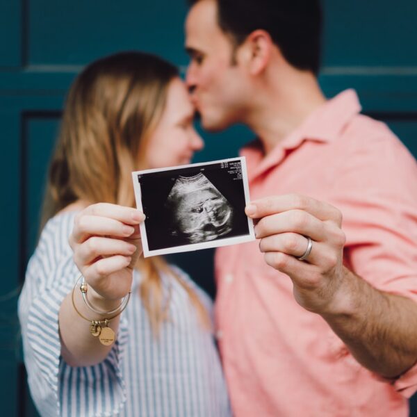 man kissing woman's forehead white holding ultrasound photo
