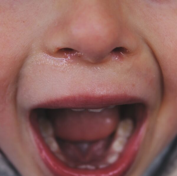 boy opening his mouth